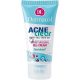 Dermacol ACNEclear Moisturising Gel-Cream Gelcreme für problematische Haut 50 ml